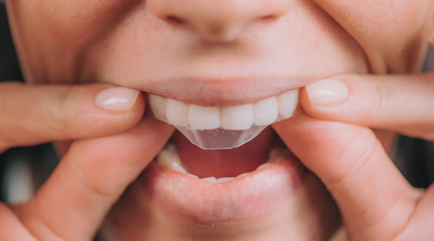 White Lies: The Truth About Why Your Teeth Aren't Getting Whiter (Despite Everything You're Trying)