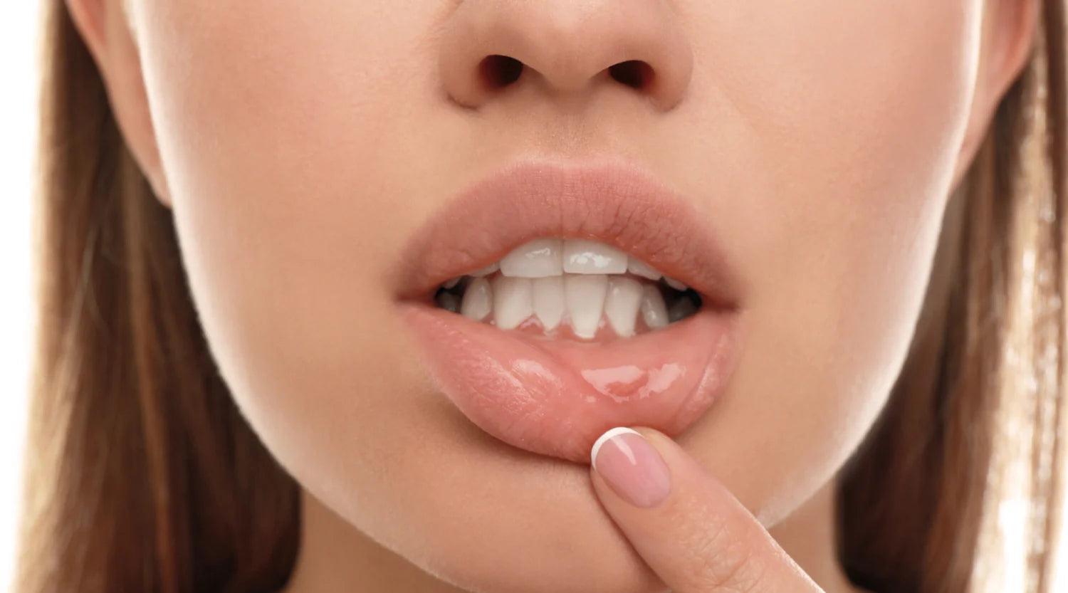 When to Worry About Persistent Mouth Sores: Warning Signs You Shouldn't Ignore