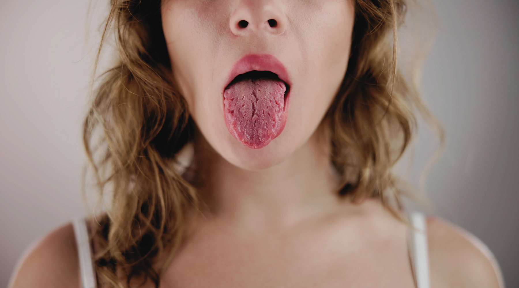 Is There a Link Between Tongue Coating and Immune Function?