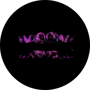 Care for your mouth illustrated with a glowing purple dental plaque visualization on teeth against a black background.