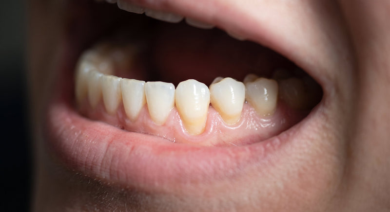 Why Cold Drinks Make Your Teeth Hurt (And When to Worry)