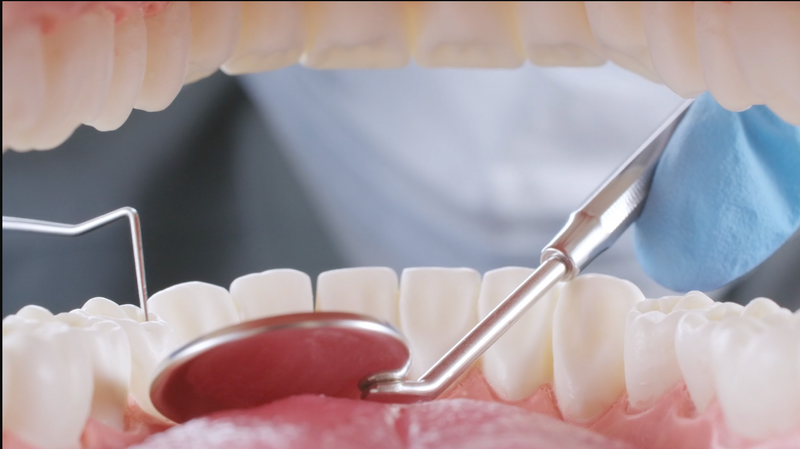 Oral hygiene checkup showing a dental mirror & scaler inspecting clean teeth & healthy gums