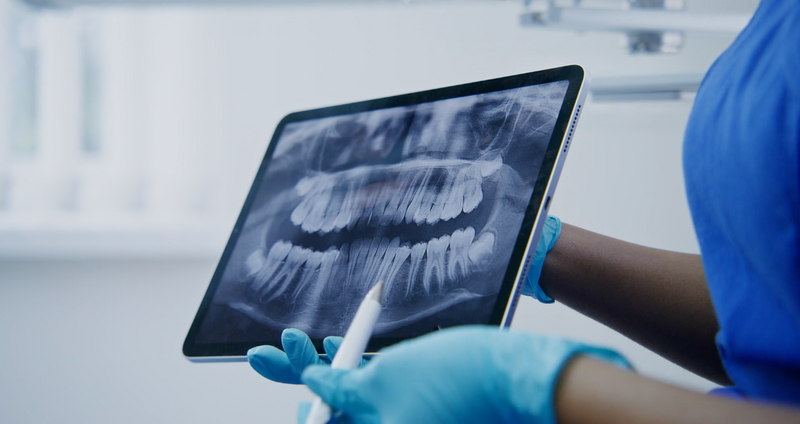 Dentist analyzing a dental X-ray on a tablet, highlighting teeth & jaw structure for oral health assessment
