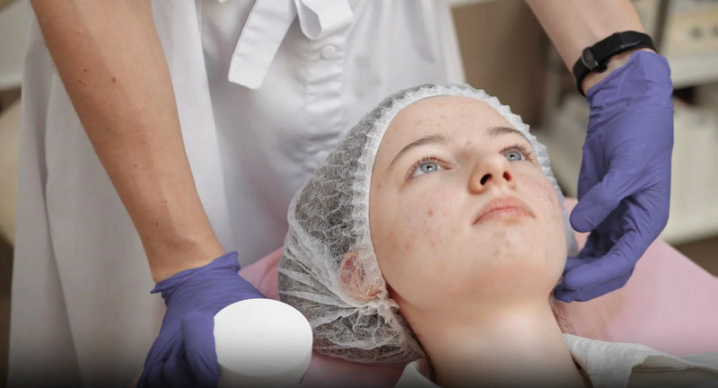 The Surprising Connection: Oral Inflammation and Skin Breakouts