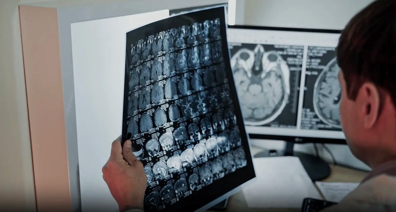 Radiologist examining brain MRI film scans against monitors showing detailed cross-sectional imaging.