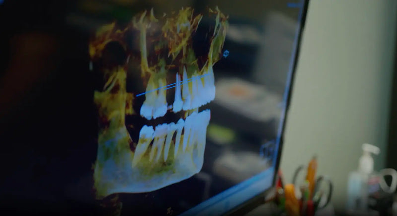 Tooth Fell Out. Is It an Emergency?