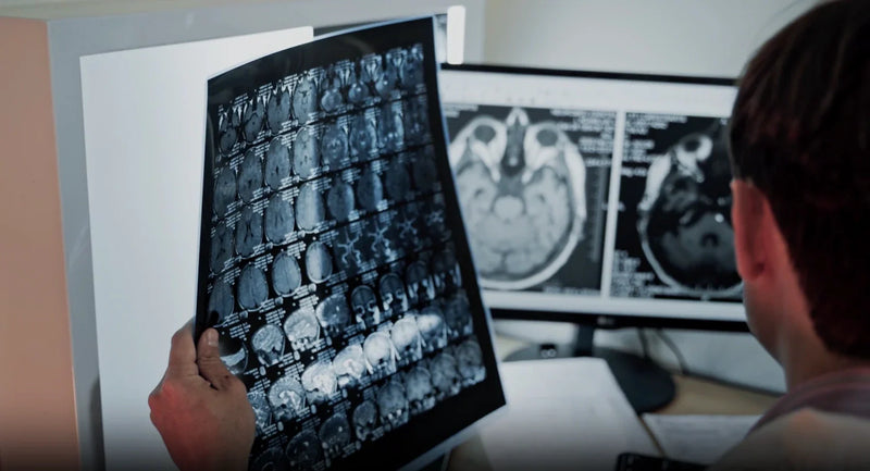 Clinician reviewing brain MRI film scans beside monitors showing Parkinson's disease imaging.