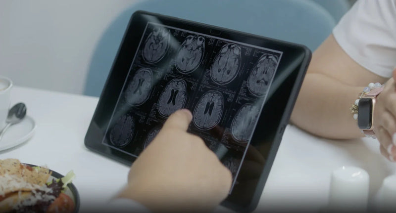 Hand pointing at brain MRI scans on a tablet illustrating the oral health brain connection.