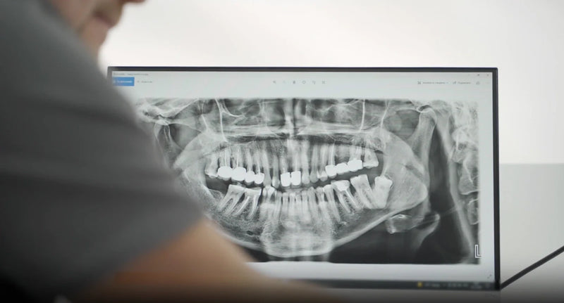 Person viewing a panoramic dental x-ray of teeth and jaw on a laptop screen.
