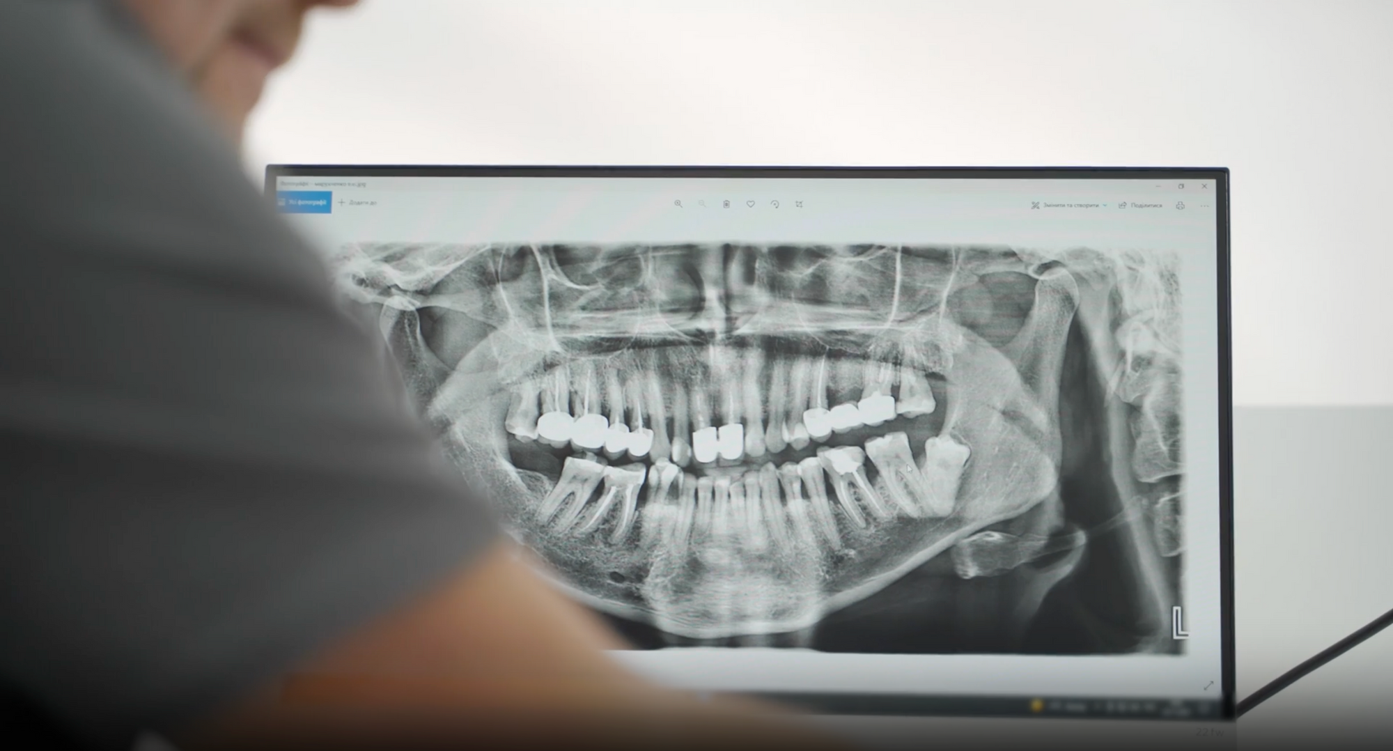 How Autoimmune Disorders Destroy Your Oral Health (And What to Do About It)