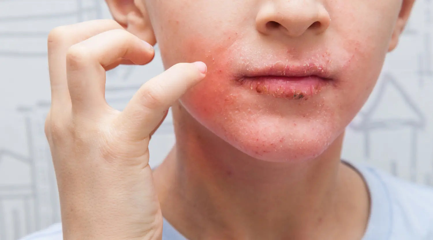 Can Brushing Poorly Irritate the Skin Around the Lips or Chin?