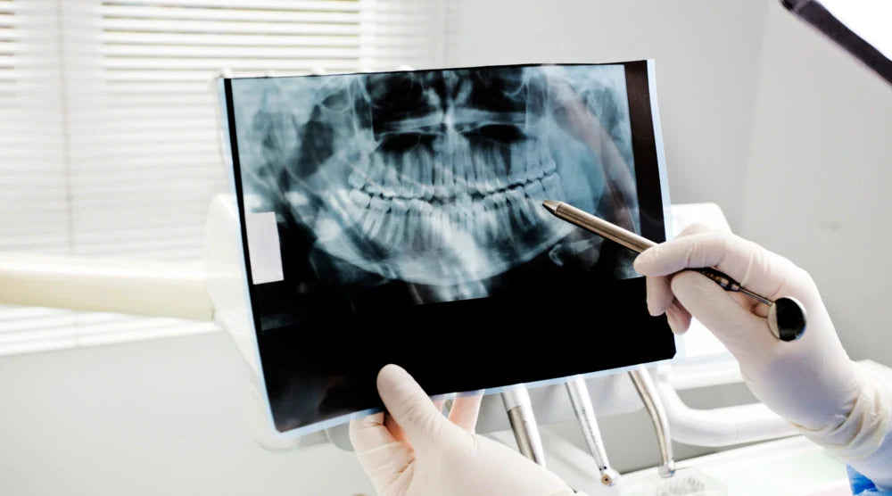 Gloved dentist points to a panoramic dental X-ray showing full upper and lower teeth.