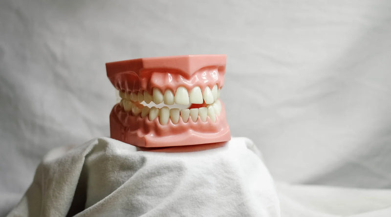 Dental model of upper and lower teeth resting on white cloth, illustrating tooth loss risks.
