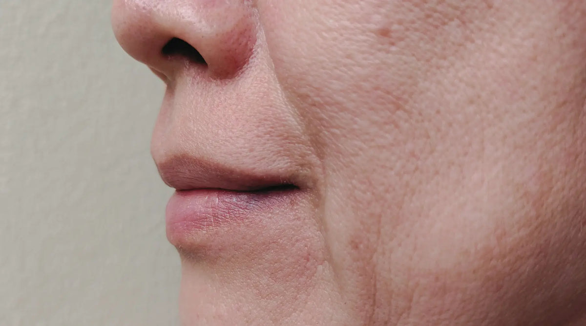 Side profile close-up of lips, nose, and fine lines around an aging mouth area.