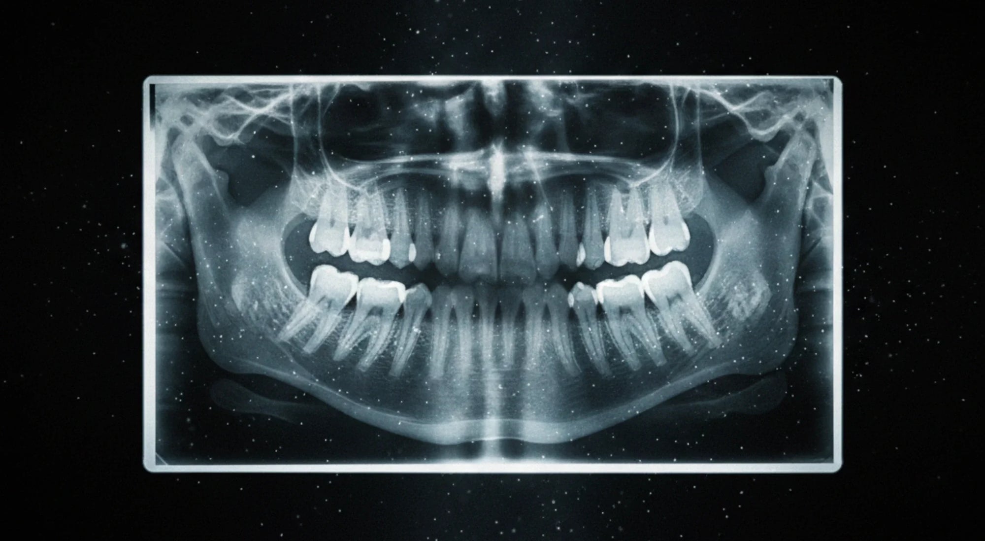 What to Expect When Returning to the Dentist After Years Away