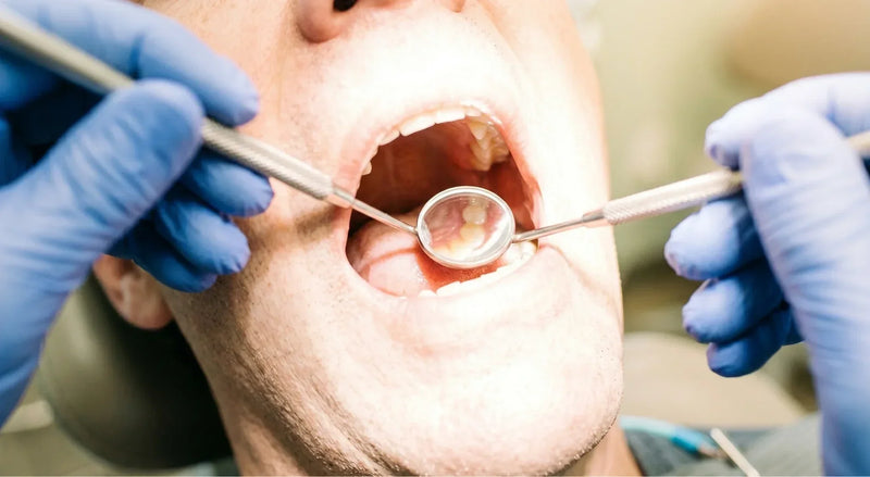 Dentist examines a patient's open mouth using a mirror and probe during a checkup.
