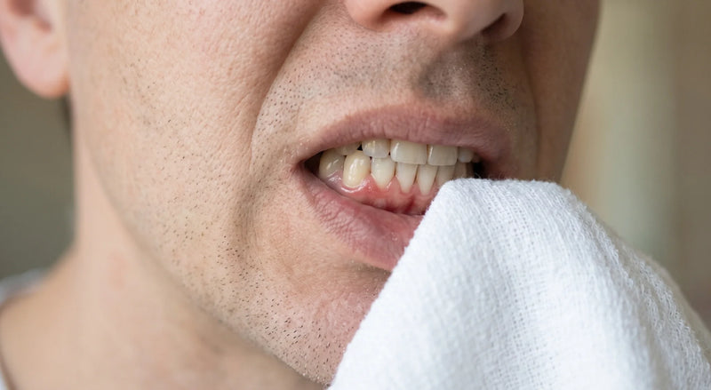 Could Your Gums Be Fueling Autoimmune Disease?