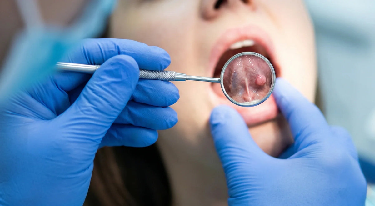Dentist using a mirror to examine a lump under a patient's tongue during a checkup.