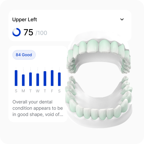 Feno app oral health score gauge displaying a rating of 84 out of 100 labeled as good.