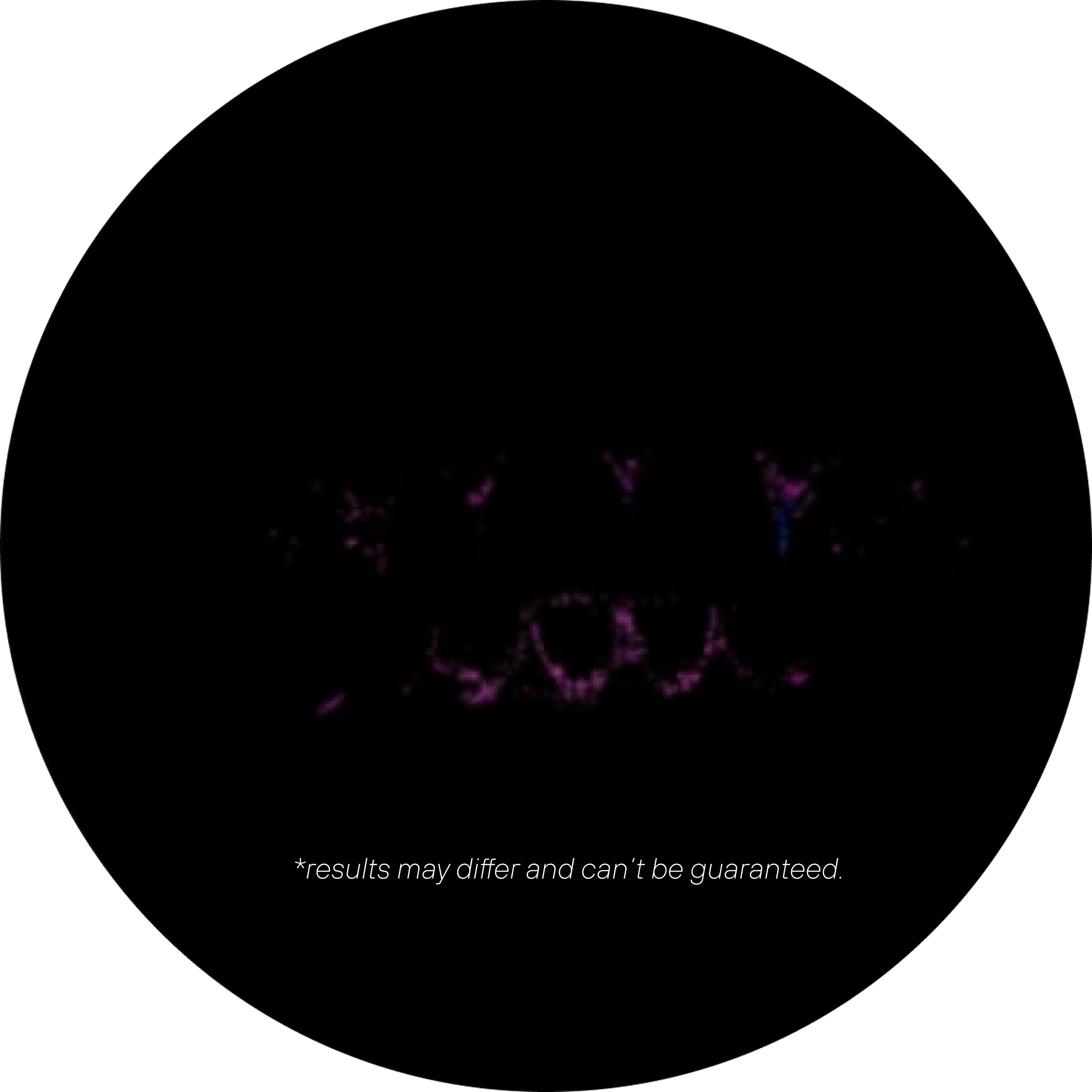 Visualização de placa dental com luz UV - Feno Smartbrush