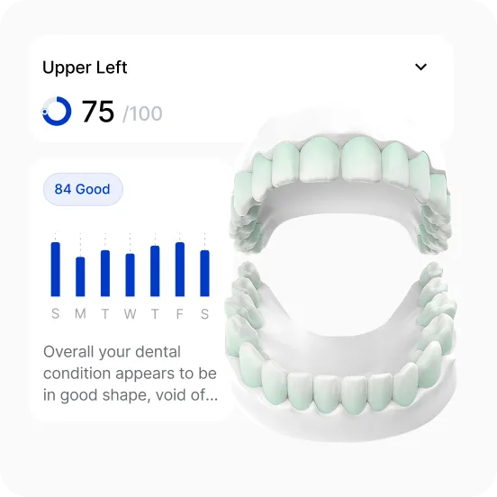 Feno app oral health score gauge displaying a rating of 84 out of 100 labeled as good.