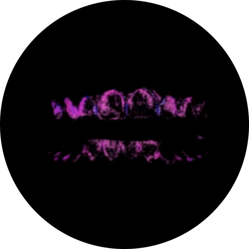 Care for your mouth illustrated with a glowing purple dental plaque visualization on teeth against a black background.