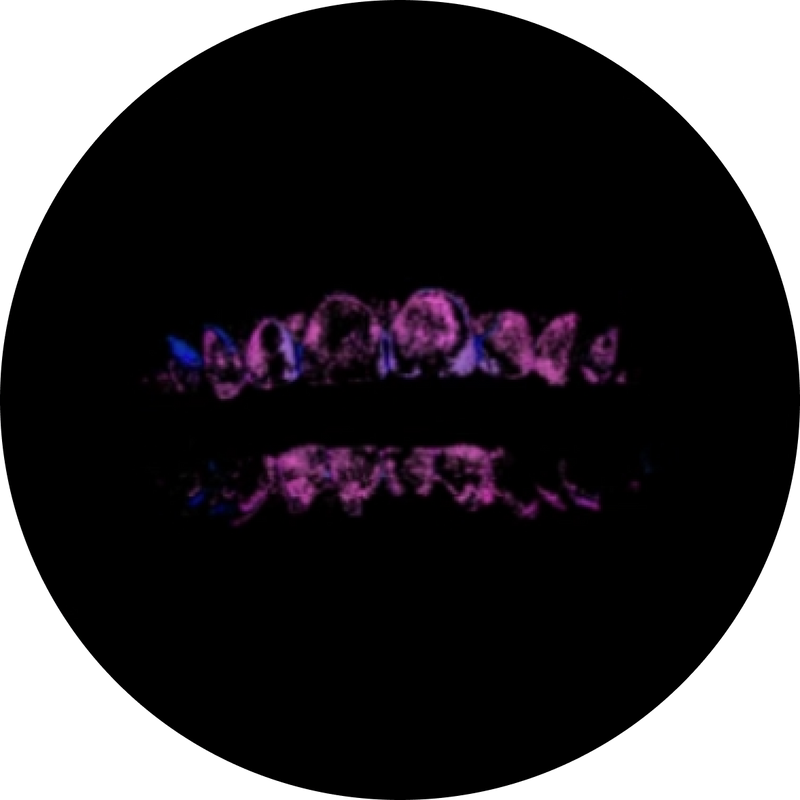 Purple teeth visualization of dental plaque & bacteria in bright pink and blue colors on teeth, set against a black background